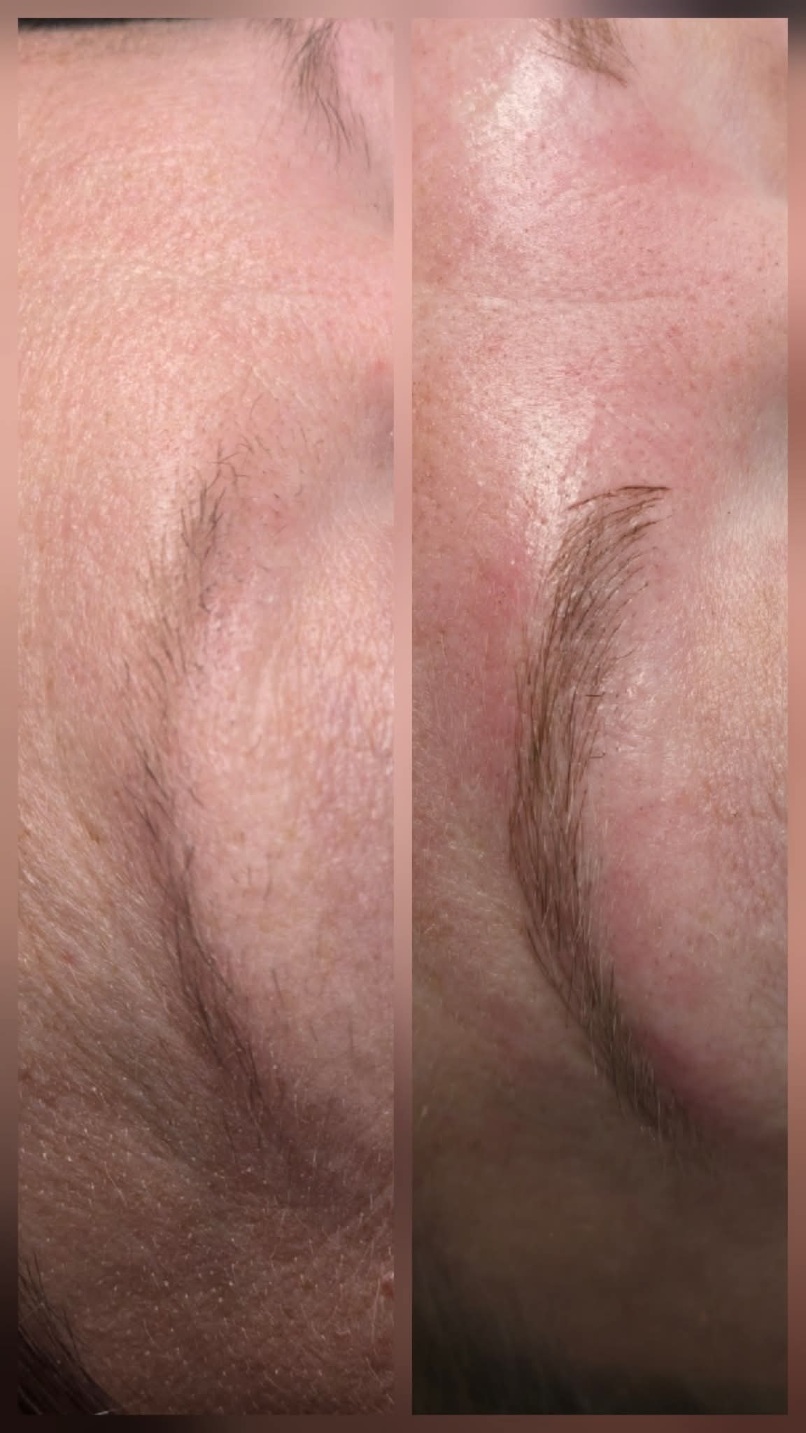Brow touch-up results - Ottawa IL